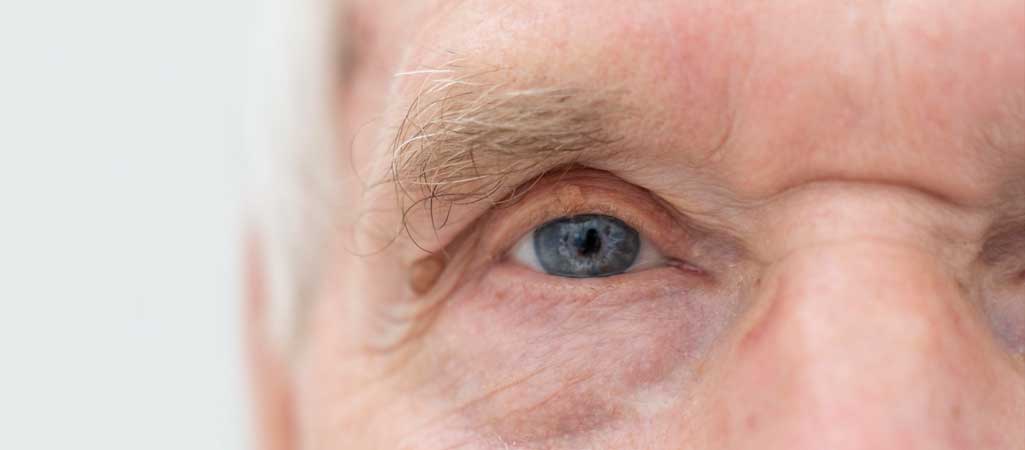 Glaucoma Treatment in