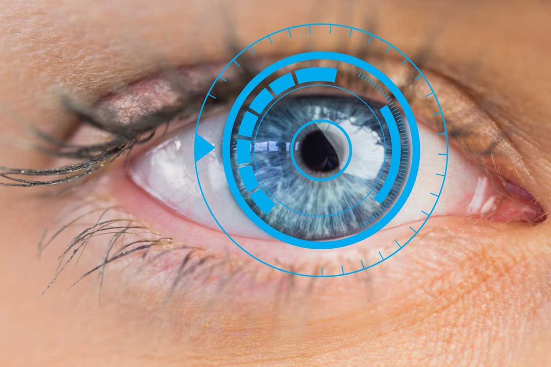 Flapless LASIK eye surgery at Kenia Eye Hospital