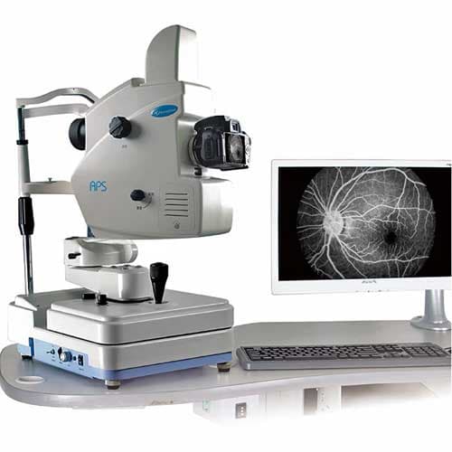 Fundus Fluorescein Angiography