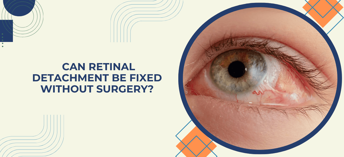 Can Retinal Detachment Be Fixed Without Surgery? What Really Works