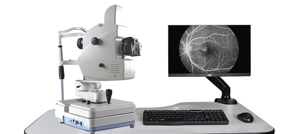 Fundus Fluorescein Angiography