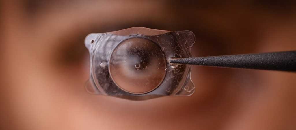 ICL Eye Surgery in