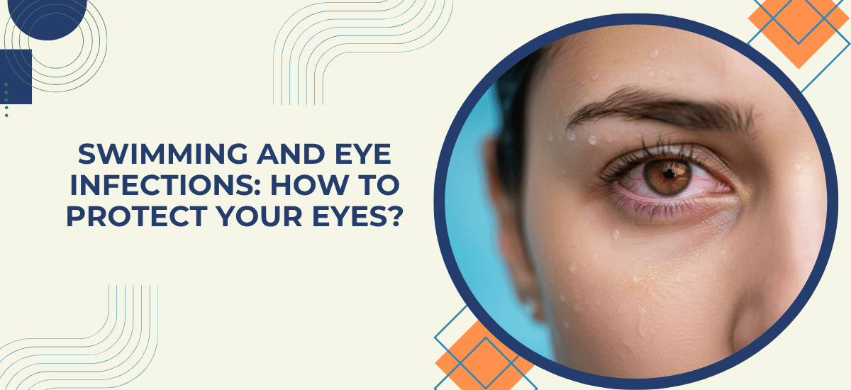 Swimming and Eye Infections: How to Protect Your Eyes in Pools