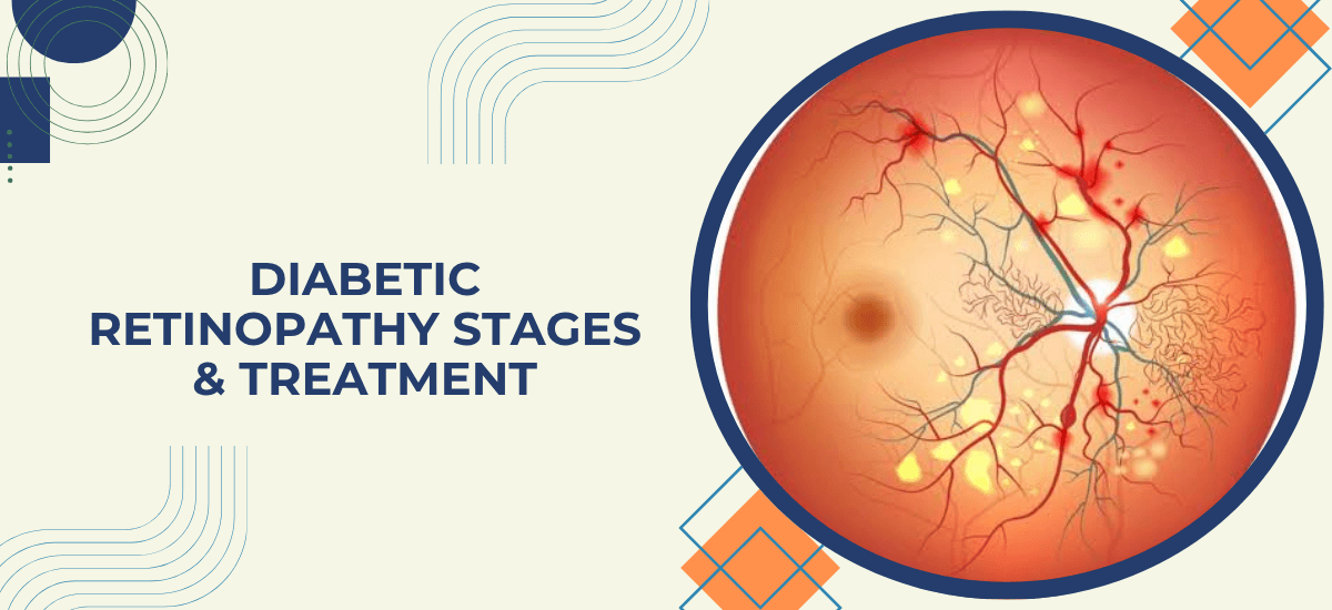 Diabetic Retinopathy: Stages, Symptoms & Treatment