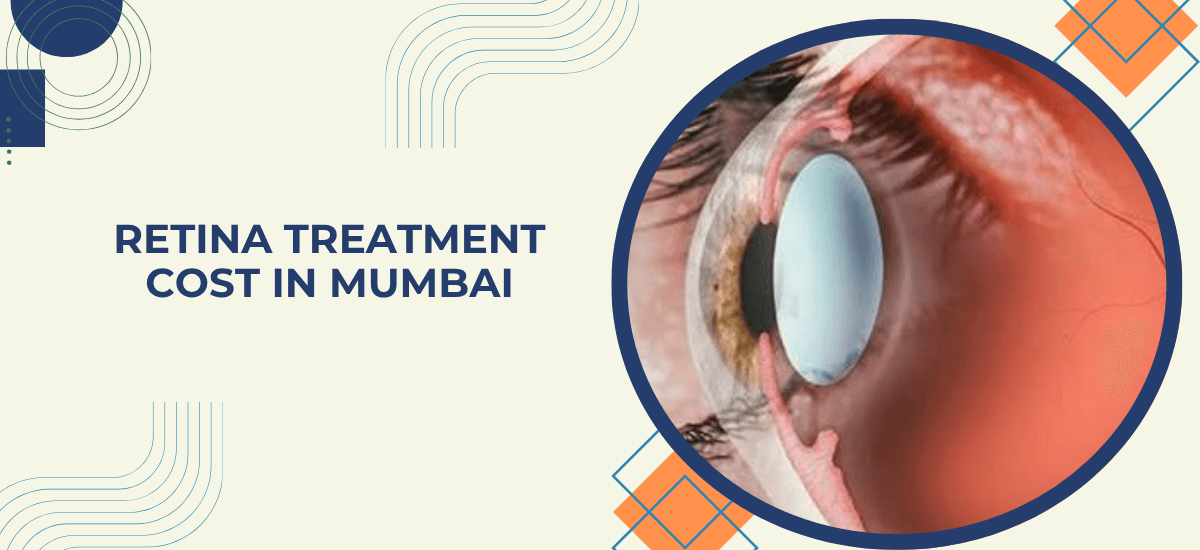 Retina Treatment Cost in Mumbai: Injections, Laser & Surgery Explained