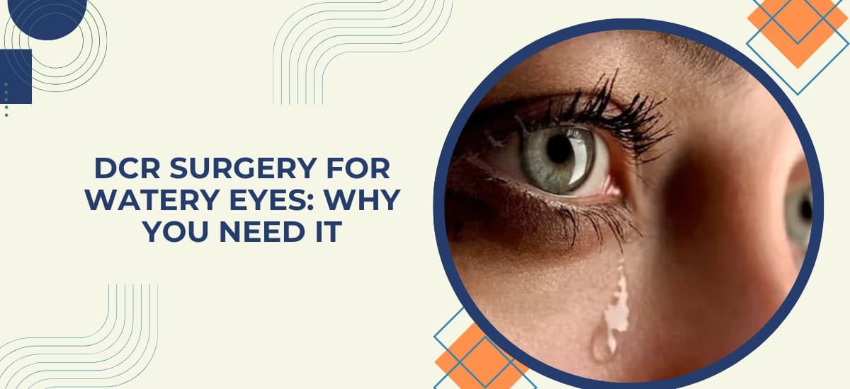 DCR Surgery for Watery Eyes: Why You Need It