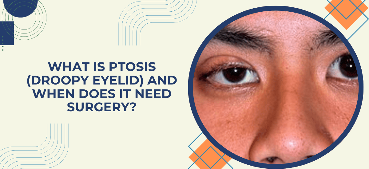 What Is Ptosis (Droopy Eyelid) and When Does It Need Surgery?