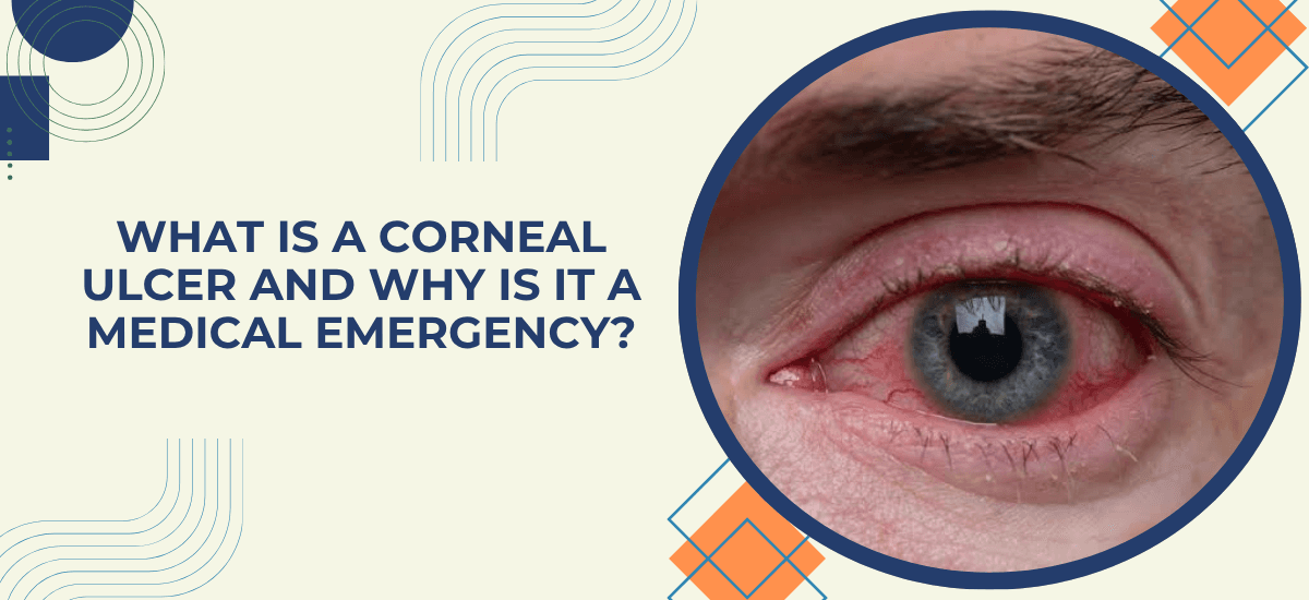 What Is a Corneal Ulcer and Why Is It a Medical Emergency?
