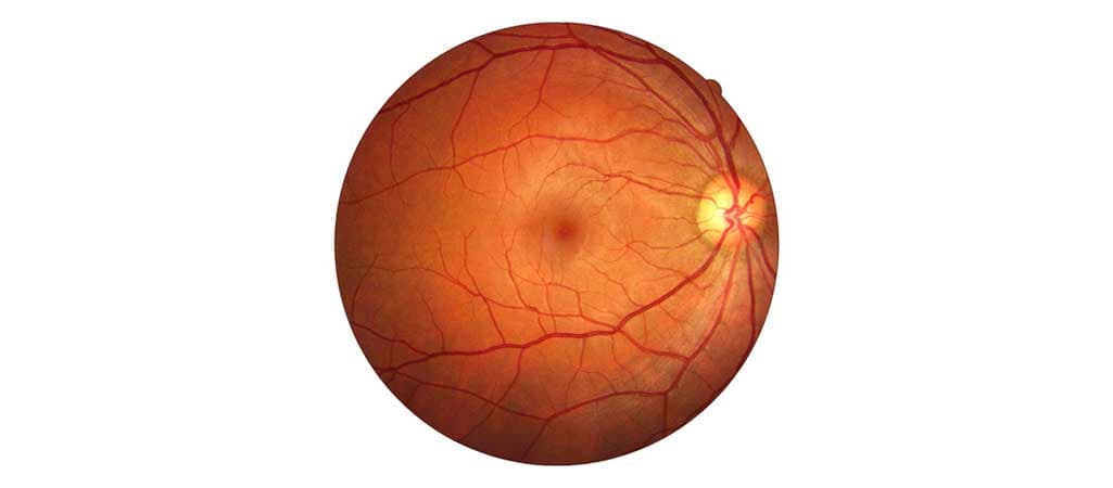 Retina Specialist in