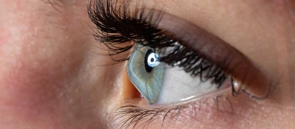 Keratoconus Treatment in