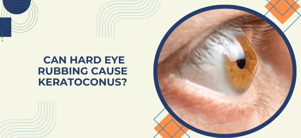 Can Hard Eye Rubbing Cause Keratoconus?