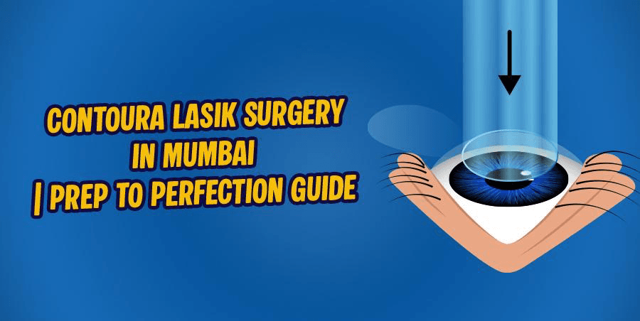 Ultimate Guide to the Contoura LASIK Surgery - Experience from Prep to Perfection