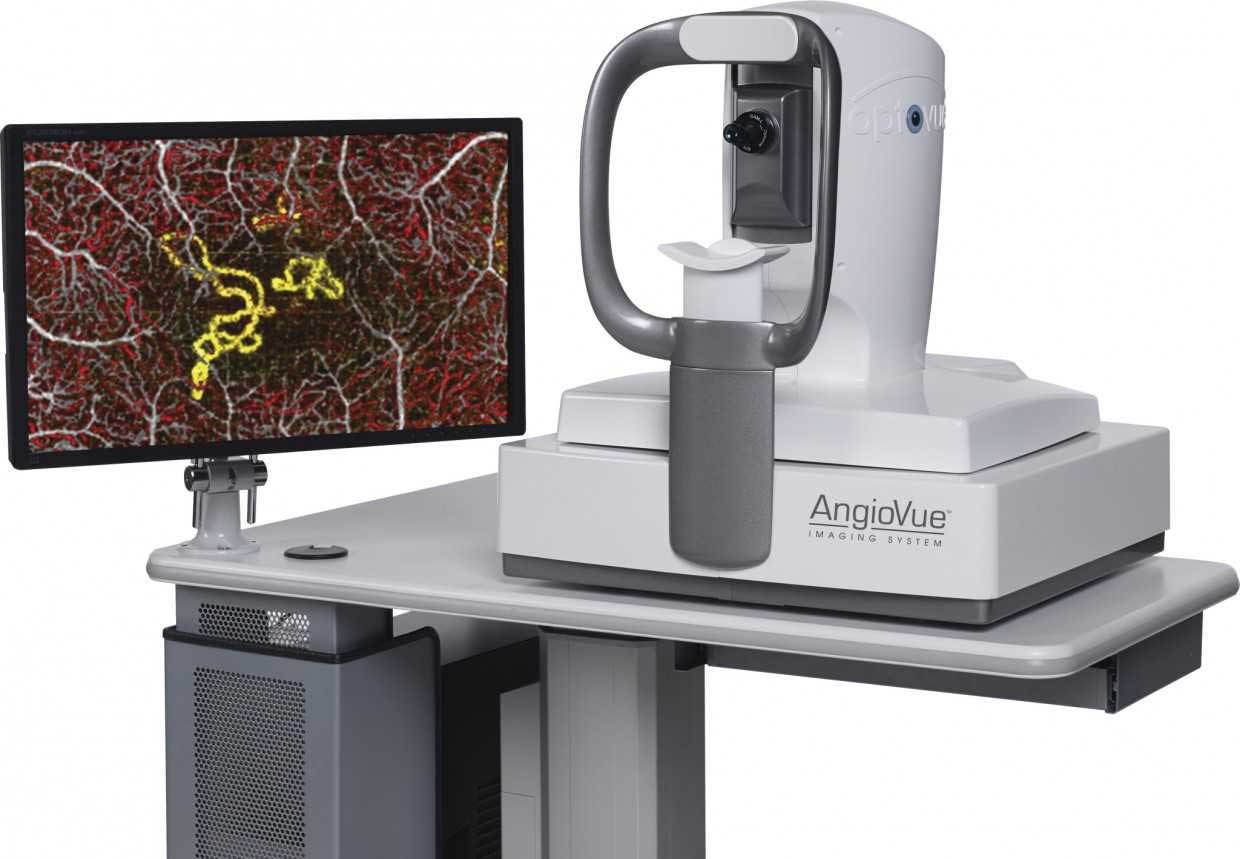 OCT retinal imaging equipment