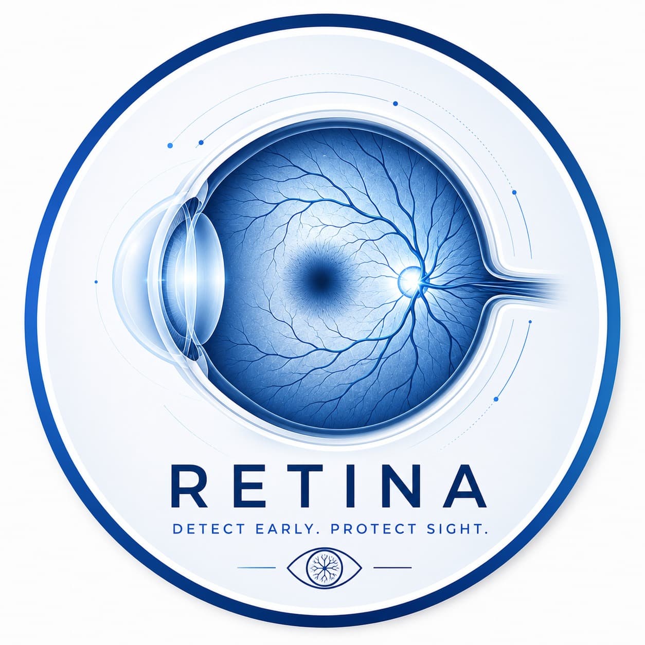 Retina