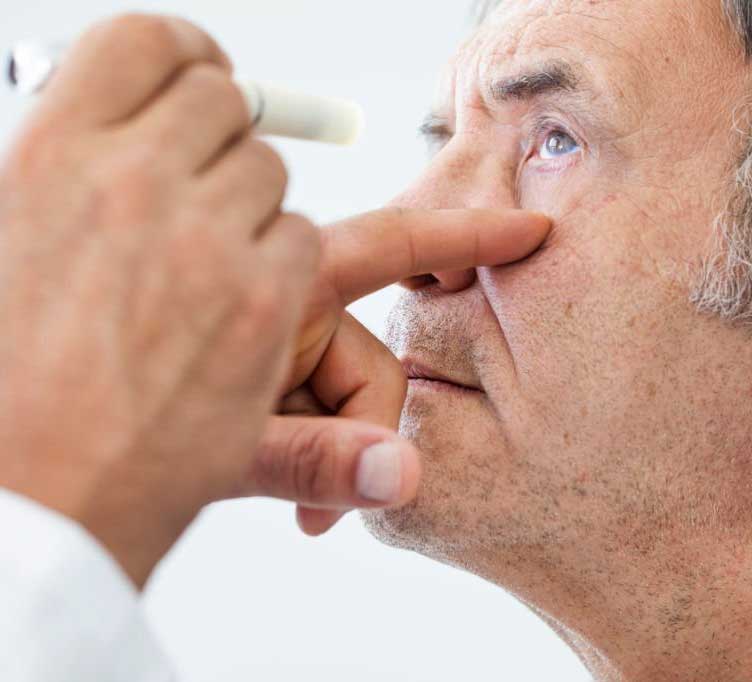 Visual representation of cataract surgery after LASIK procedure