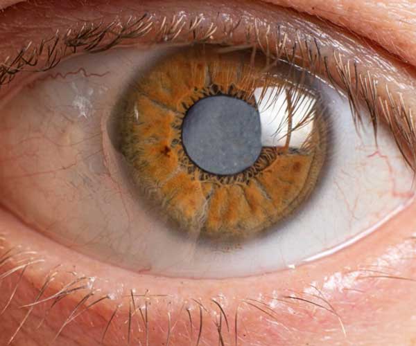 Visual guide to identifying common eye diseases and symptoms