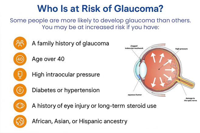 risk of glaucoma