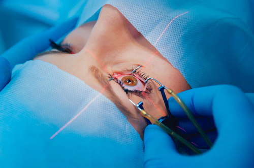 Image showing Contoura LASIK advanced vision correction technology at Kenia Eye Hospital