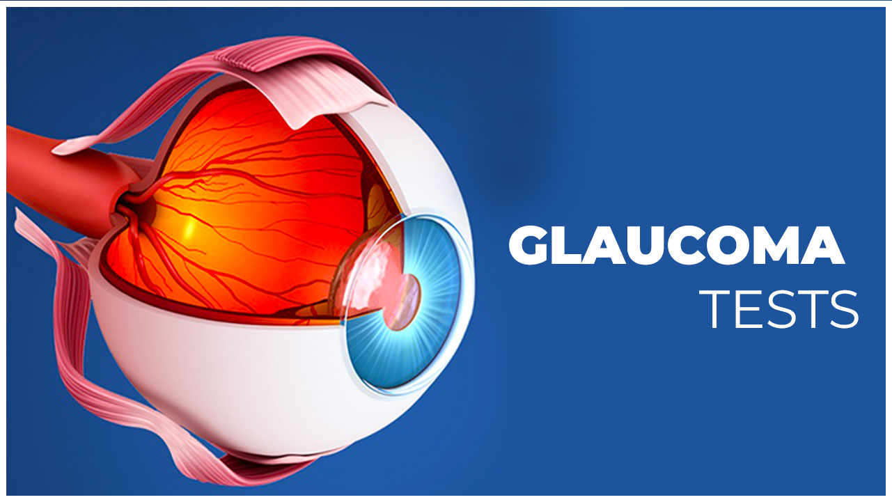 Glaucoma Tests