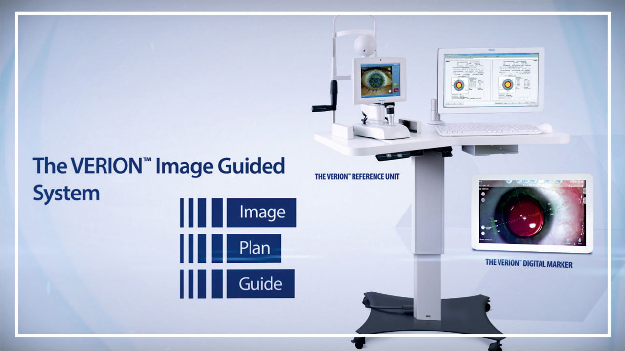 Image Guided Cataract Surgery