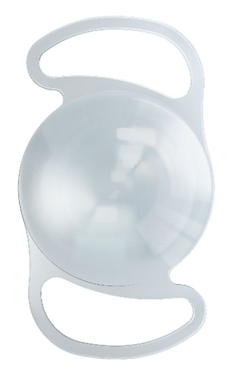 glaucoma surgery