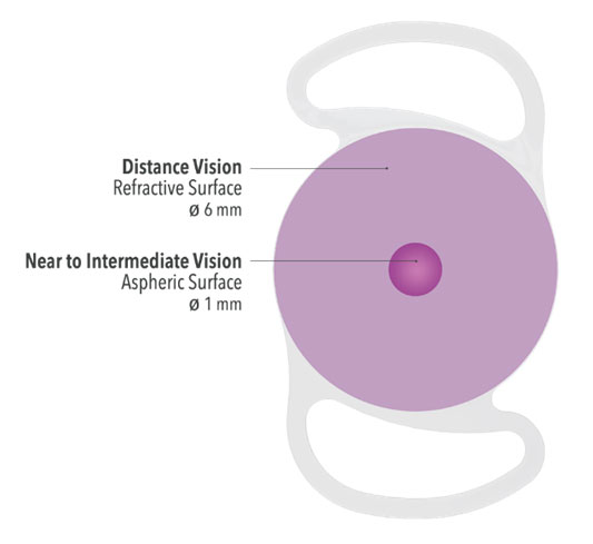 glaucoma clinic