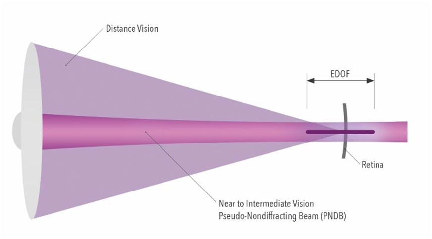 glaucoma clinic