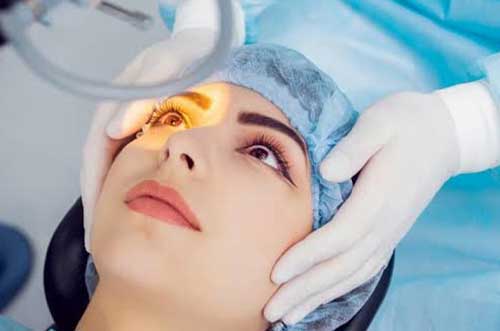 Image showing LASIK laser eye surgery procedure for vision correction