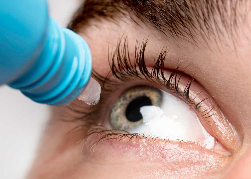 Visual guide to eye care after cataract surgery for optimal healing