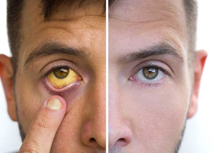 Close-up image focused on eye health and vision care featured in Kenia Eye Hospital blog