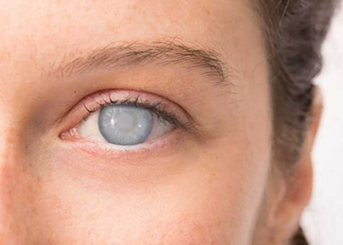 Visual related to eye health education and preventive care tips at Kenia Eye Hospital