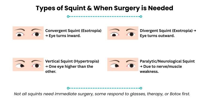 squint eye surgery mumbai cost age limit1