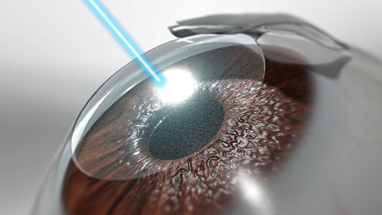 lasik in covid