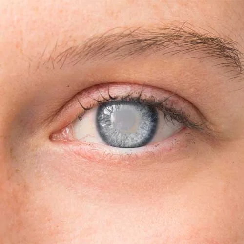 Kenia Eye Hospital