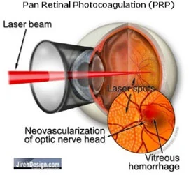 Kenia Eye Hospital