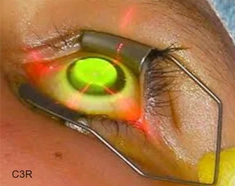 Kenia Eye Hospital