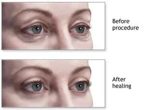 Kenia Eye Hospital