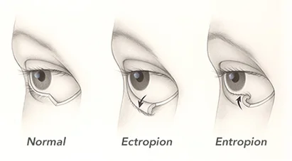 Kenia Eye Hospital