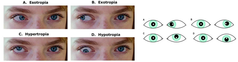 Kenia Eye Hospital